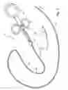Fig. 04 - Methods and devices for diagnostic and therapeutic interventions in the peritoneal cavity
