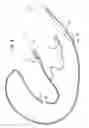 Fig. 06 - Methods and devices for diagnostic and therapeutic interventions in the peritoneal cavity