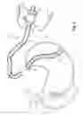 Fig. 07 - Methods and devices for diagnostic and therapeutic interventions in the peritoneal cavity