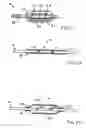 Fig. 04 - Tissue positioning systems and methods for use with radiation therapy