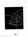 Fig. 02 - Ultrasound diagnostic imaging system and method for 3D qualitative display of 2D border tracings
