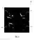 Fig. 05 - Ultrasound diagnostic imaging system and method for 3D qualitative display of 2D border tracings