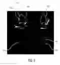 Fig. 06 - Ultrasound diagnostic imaging system and method for 3D qualitative display of 2D border tracings