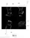Fig. 09 - Ultrasound diagnostic imaging system and method for 3D qualitative display of 2D border tracings