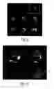 Fig. 10 - Ultrasound diagnostic imaging system and method for 3D qualitative display of 2D border tracings