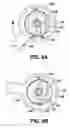 Fig. 06 - Ultrasound guided probe device and method of using same
