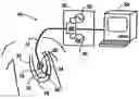 Fig. 01 - Software for mapping potential distribution of a heart chamber