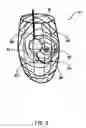 Fig. 06 - Software for mapping potential distribution of a heart chamber