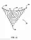 Fig. 08 - Software for mapping potential distribution of a heart chamber