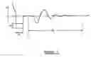 Fig. 08 - Method and apparatus for measurement of evoked neural response