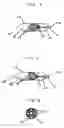 Fig. 05 - Safety pressure device for body fluid extraction