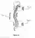 Fig. 08 - Therapeutic spinal rest and support