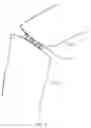 Fig. 06 - Injury immobilization device