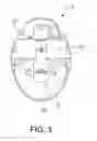 Fig. 03 - Cervical collar having enhanced lateral support
