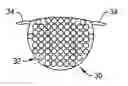 Fig. 01 - Band aid applique