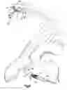 Fig. 06 - Apparatus and method for auto-retroperfusion of a coronary vein