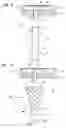 Fig. 07 - Interventional diagnostic catheter and a method for using a catheter to access artificial cardiac shunts