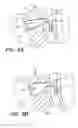 Fig. 12 - Left ventricular conduits to coronary arteries and methods for coronary bypass