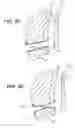 Fig. 20 - Left ventricular conduits to coronary arteries and methods for coronary bypass