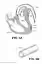 Fig. 26 - Left ventricular conduits to coronary arteries and methods for coronary bypass