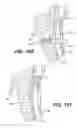 Fig. 38 - Left ventricular conduits to coronary arteries and methods for coronary bypass