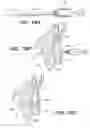 Fig. 47 - Left ventricular conduits to coronary arteries and methods for coronary bypass