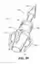 Fig. 58 - Left ventricular conduits to coronary arteries and methods for coronary bypass