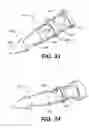 Fig. 61 - Left ventricular conduits to coronary arteries and methods for coronary bypass