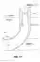 Fig. 72 - Left ventricular conduits to coronary arteries and methods for coronary bypass