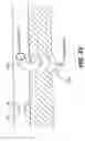 Fig. 74 - Left ventricular conduits to coronary arteries and methods for coronary bypass