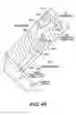 Fig. 76 - Left ventricular conduits to coronary arteries and methods for coronary bypass