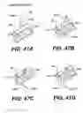 Fig. 78 - Left ventricular conduits to coronary arteries and methods for coronary bypass