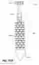 Fig. 86 - Left ventricular conduits to coronary arteries and methods for coronary bypass