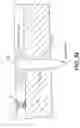 Fig. 87 - Left ventricular conduits to coronary arteries and methods for coronary bypass