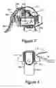 Fig. 04 - Powered breast pump