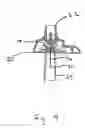 Fig. 10 - Subcutaneous infusion set