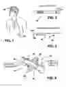 Fig. 02 - Catheter anchor system and method