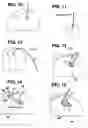 Fig. 04 - Catheter anchor system and method