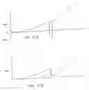 Fig. 05 - Anesthetic dental injection apparatus and methods