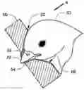 Fig. 01 - Apparatus and method for nasal delivery of compositions to birds