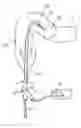 Fig. 01 - Guidewire for use in colonic irrigation