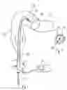 Fig. 02 - Guidewire for use in colonic irrigation