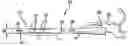 Fig. 01 - Indwelling urinary catheter