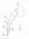 Fig. 20 - Spine distraction implant
