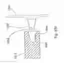 Fig. 49 - Spine distraction implant