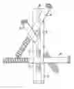 Fig. 01 - Bone fixing system