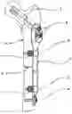 Fig. 01 - Internal fixator of bones