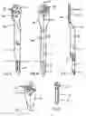 Fig. 04 - Internal fixator of bones
