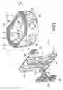 Fig. 02 - Stabilized interbody fusion system for vertebrae