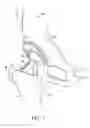 Fig. 02 - Servo-controlled impacting device for orthopedic implants